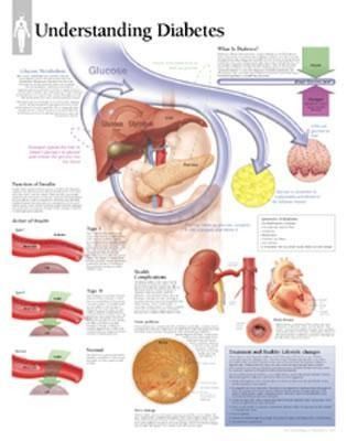 Produktbild: Understanding Diabetes Chart