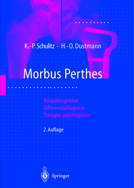 Produktbild: Morbus Perthes
