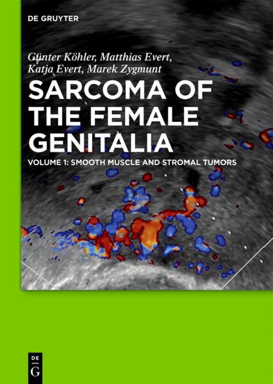 Produktbild: Smooth muscle and stromal tumors and prevention of inadequate surgery