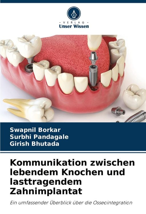 Produktbild: Kommunikation zwischen lebendem Knochen und lasttragendem Zahnimplantat
