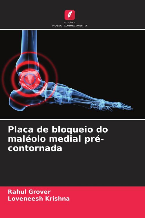 Produktbild: Placa de bloqueio do mal&eacute;olo medial pr&eacute;-contornada