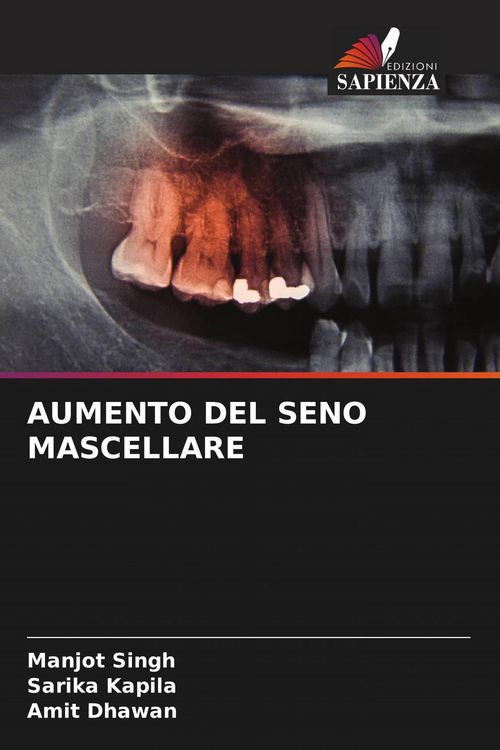 Produktbild: Aumento Del Seno Mascellare