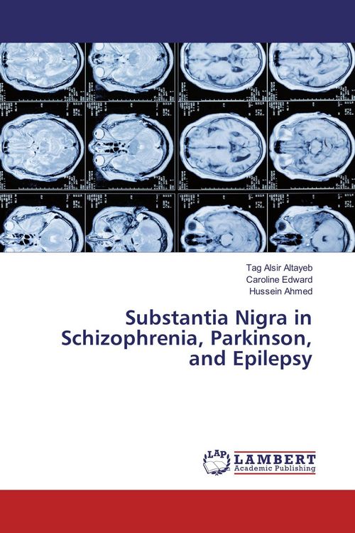 Produktbild: Substantia Nigra in Schizophrenia, Parkinson, and Epilepsy