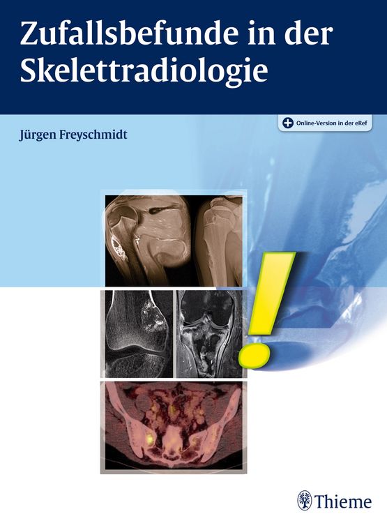 Produktbild: Zufallsbefunde in der Skelettradiologie