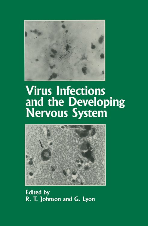 Produktbild: Virus Infections and the Developing Nervous System