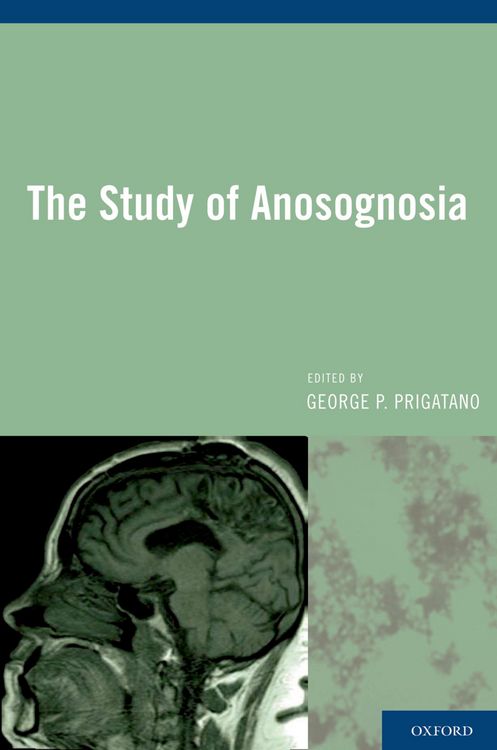 Produktbild: The Study of Anosognosia
