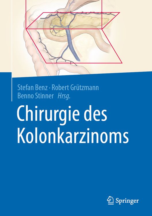 Produktbild: Chirurgie des Kolonkarzinoms