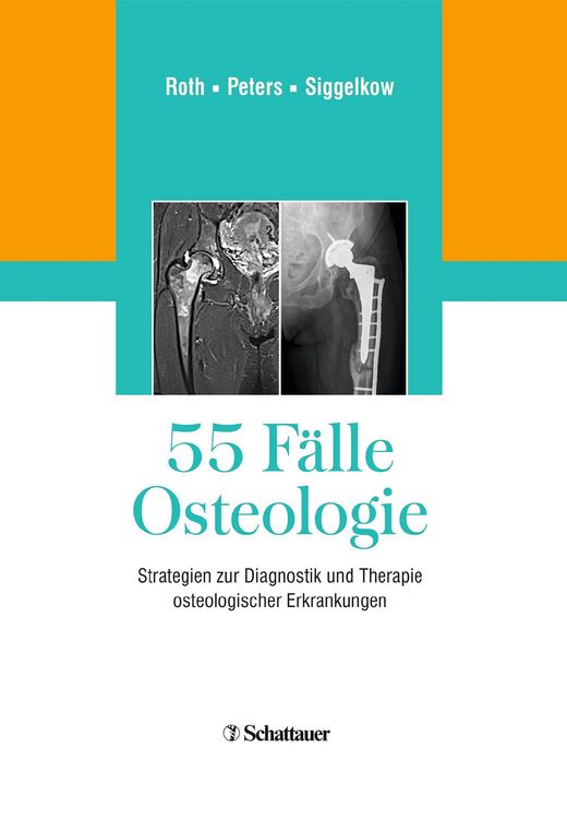 Produktbild: 55 F&auml;lle Osteologie
