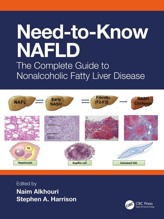 Produktbild: Need-to-Know NAFLD