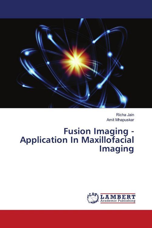 Produktbild: Fusion Imaging - Application In Maxillofacial Imaging