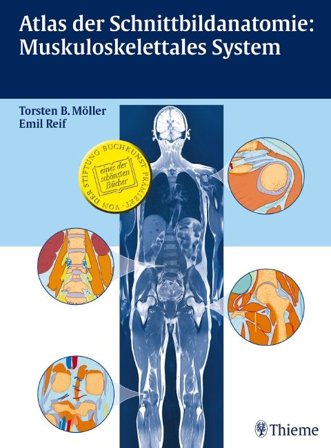 Produktbild: Atlas der Schnittbildanatomie: Muskuloskelettales System