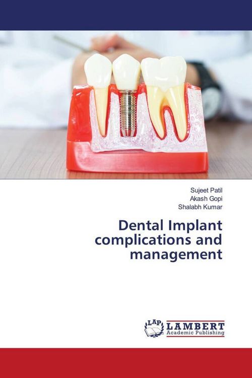 Produktbild: Dental Implant complications and management