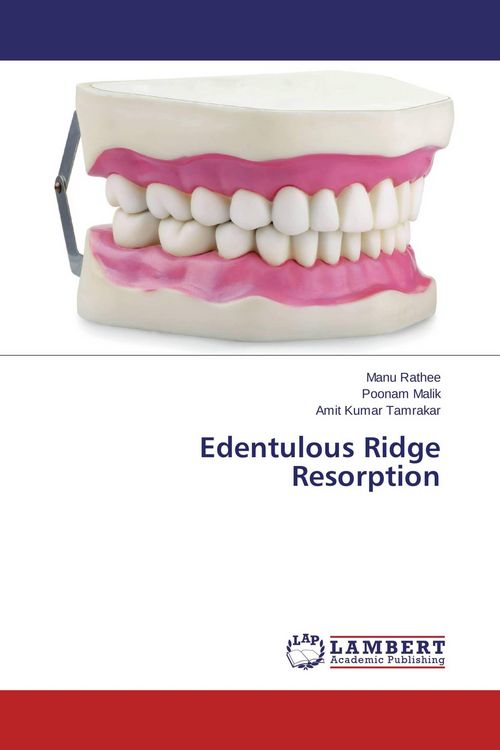 Produktbild: Edentulous Ridge Resorption