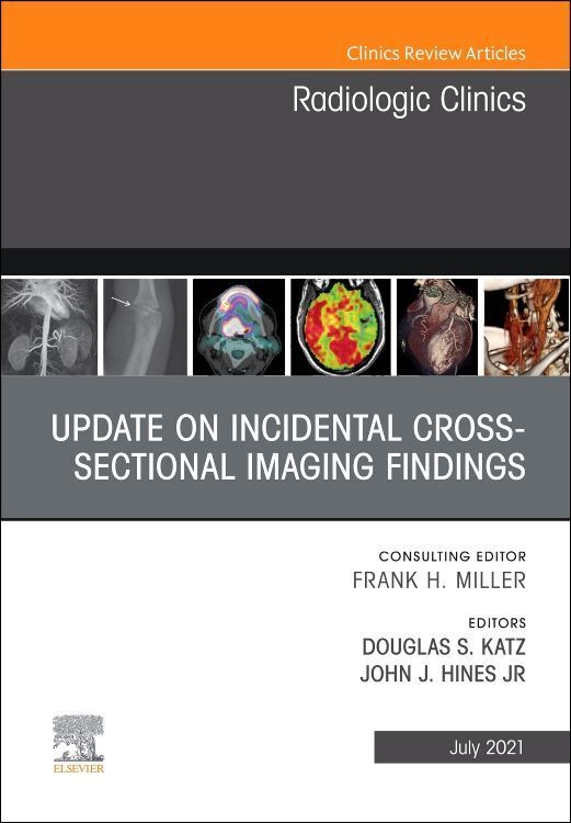 Produktbild: Update on Incidental Cross-Sectional Imaging Findings, an Issue of Radiologic Clinics of North America