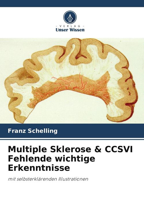 Produktbild: Multiple Sklerose & CCSVI Fehlende wichtige Erkenntnisse
