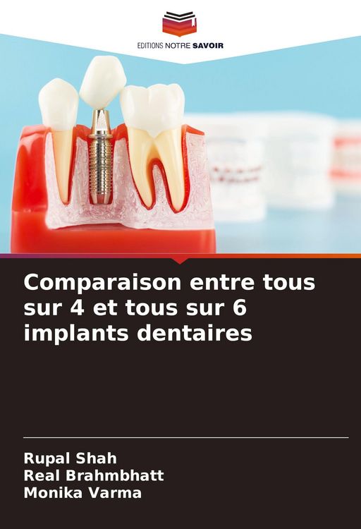 Produktbild: Comparaison entre tous sur 4 et tous sur 6 implants dentaires