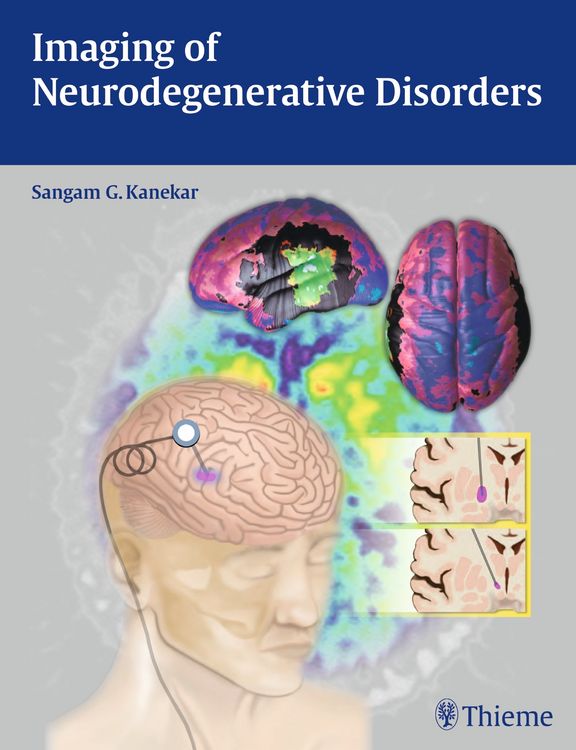 Produktbild: Imaging of Neurodegenerative Disorders