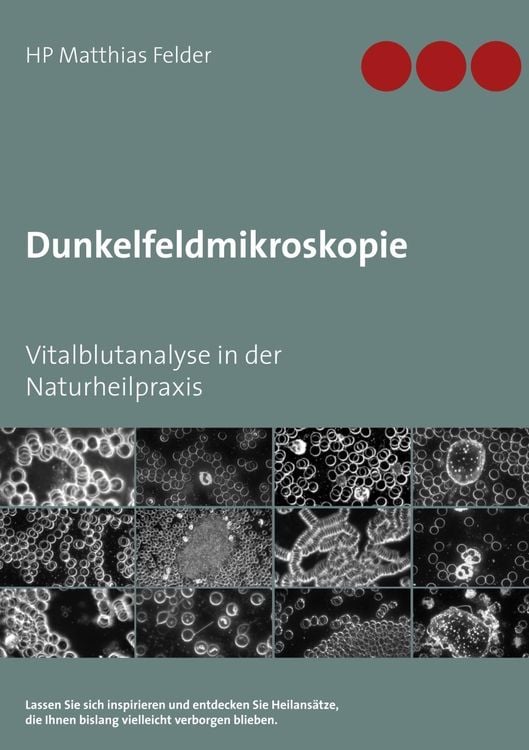 Produktbild: Dunkelfeldmikroskopie