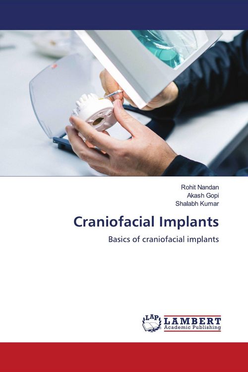 Produktbild: Craniofacial Implants