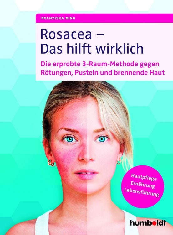 Produktbild: Rosacea - Das hilft wirklich