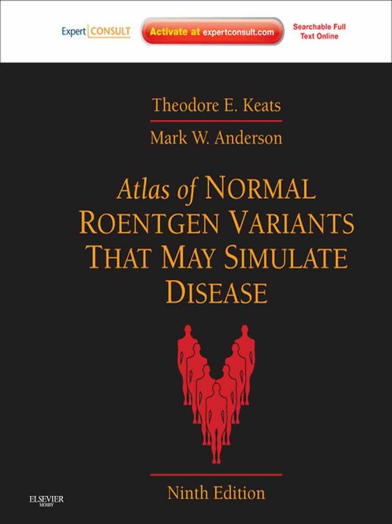 Produktbild: Atlas of Normal Roentgen Variants That May Simulate Disease E-Book