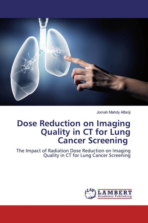 Produktbild: Dose Reduction on Imaging Quality in CT for Lung Cancer Screening