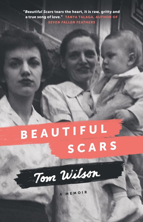 Produktbild: Beautiful Scars
