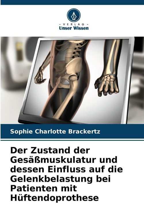 Produktbild: Der Zustand der Ges&auml;&szlig;muskulatur und dessen Einfluss auf die Gelenkbelastung bei Patienten mit H&uuml;ftendoprothese