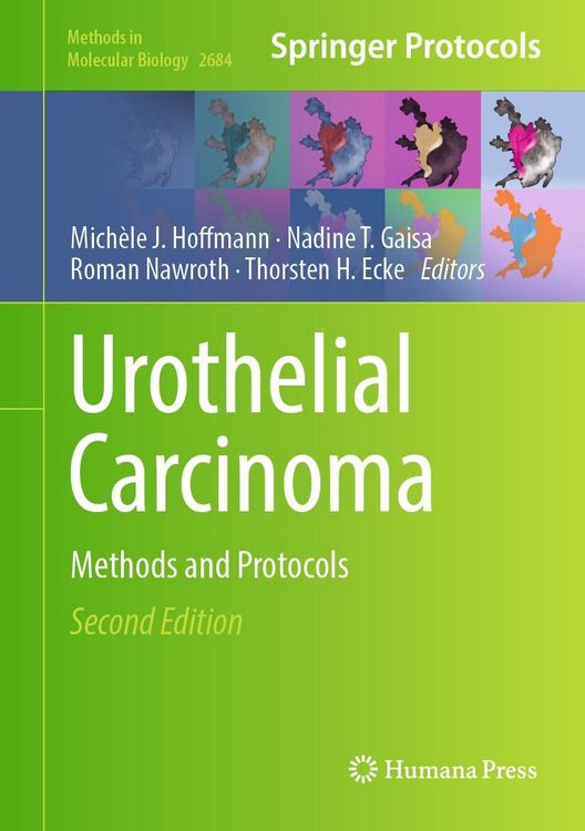 Produktbild: Urothelial Carcinoma