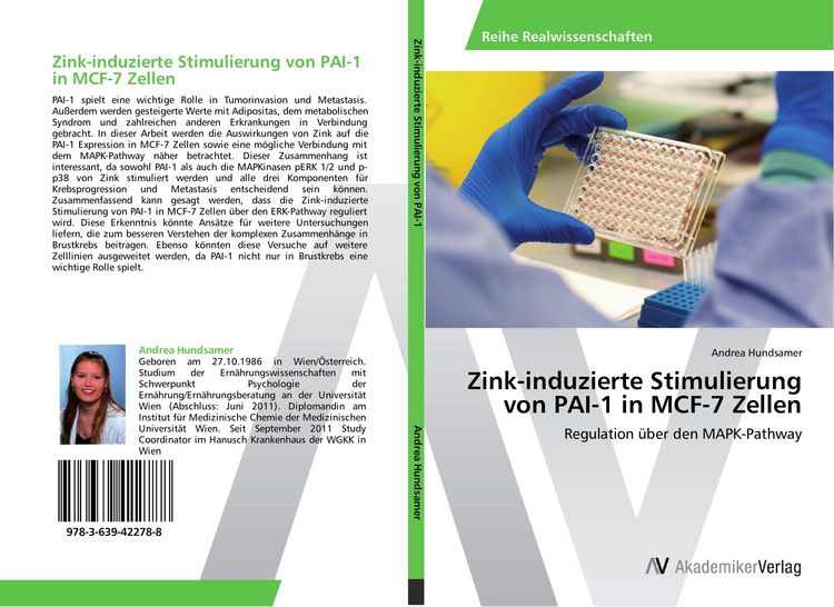 Produktbild: Zink-induzierte Stimulierung von PAI-1 in MCF-7 Zellen