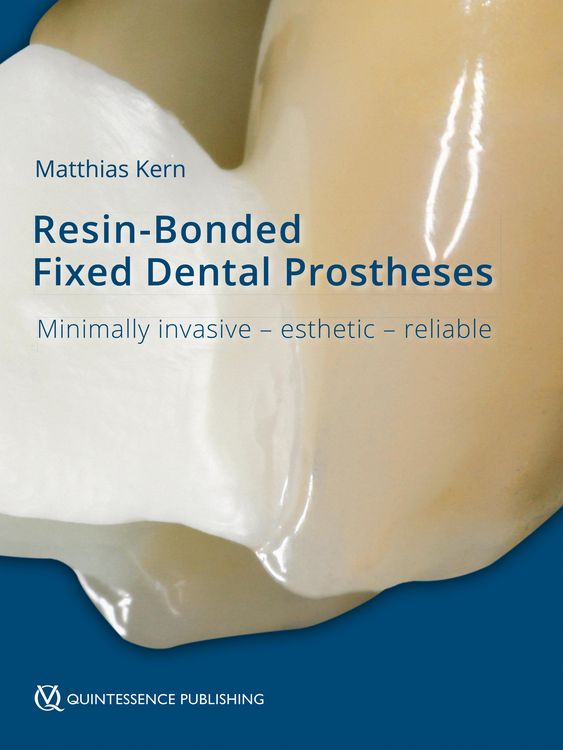 Produktbild: Resin-Bonded Fixed Dental Prostheses