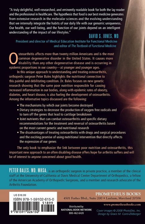 Produktbild: Osteoarthritis