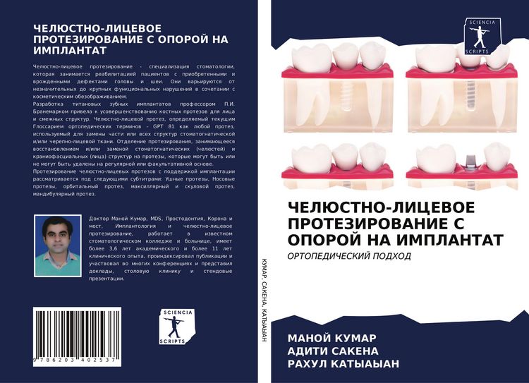 Produktbild: Cheljustno-Licevoe Protezirovanie S Oporoj Na Implantat