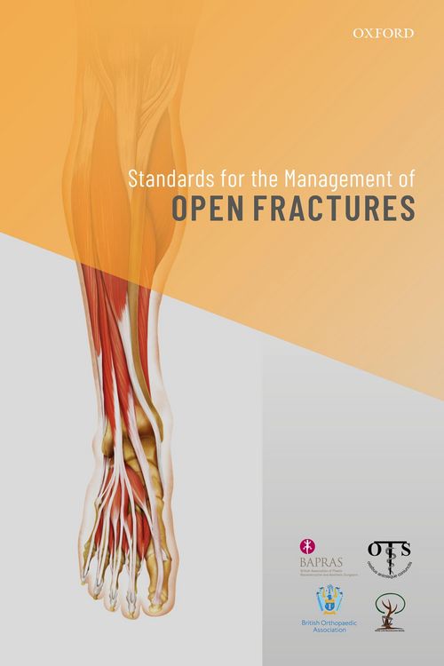 Produktbild: Standards for the Management of Open Fractures