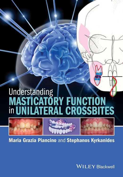 Produktbild: Understanding Masticatory Function in Unilateral Crossbites