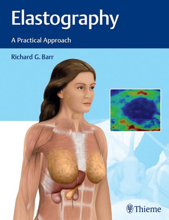 Produktbild: Elastography
