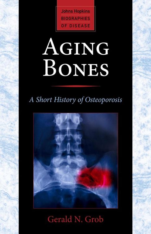 Produktbild: Aging Bones