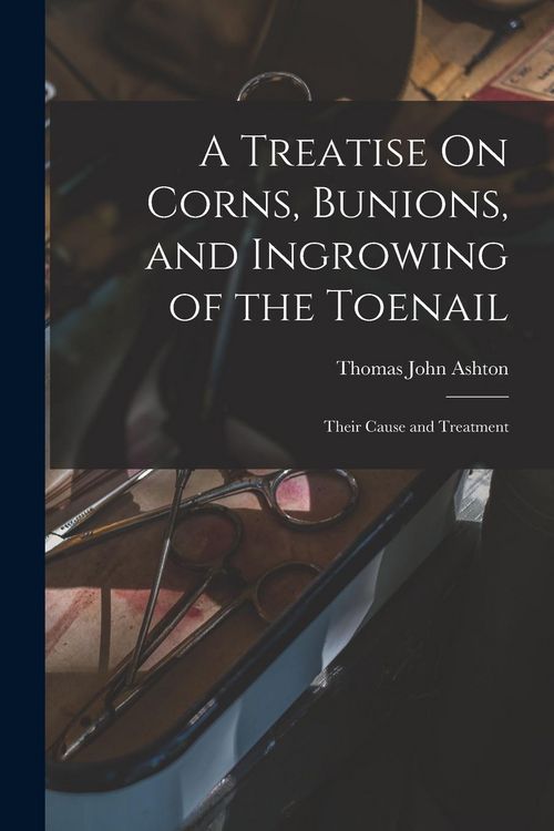 Produktbild: A Treatise On Corns, Bunions, and Ingrowing of the Toenail: Their Cause and Treatment