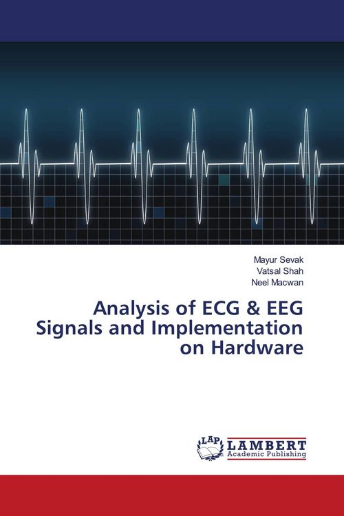 Produktbild: Analysis of ECG & EEG Signals and Implementation on Hardware