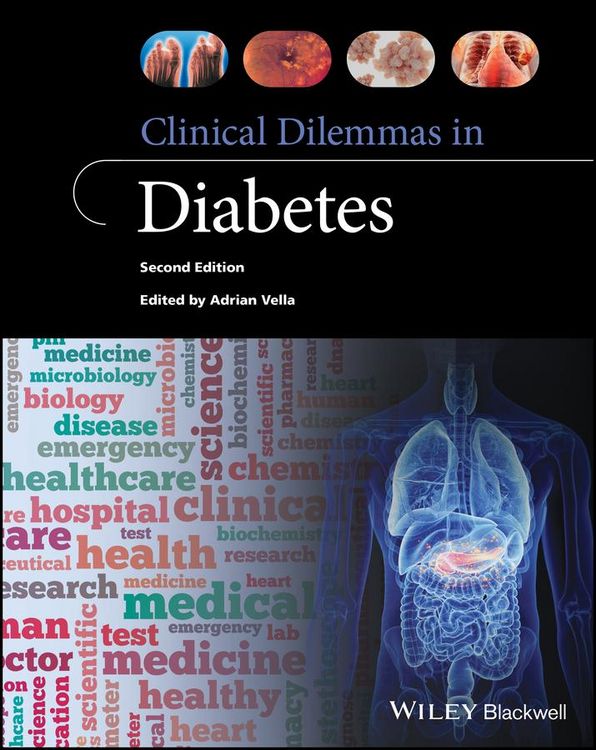 Produktbild: Clinical Dilemmas in Diabetes