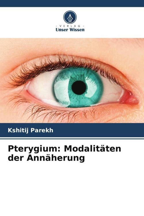 Produktbild: Pterygium: Modalit&auml;ten der Ann&auml;herung