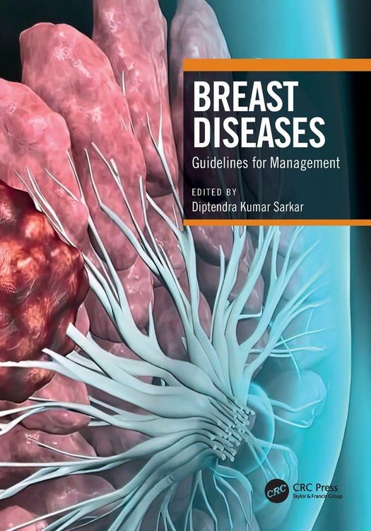 Produktbild: Breast Diseases