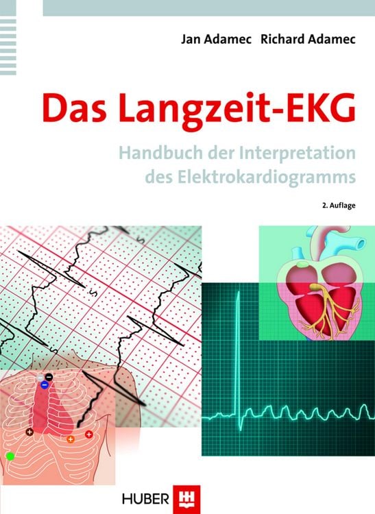 Produktbild: Das Langzeit-EKG