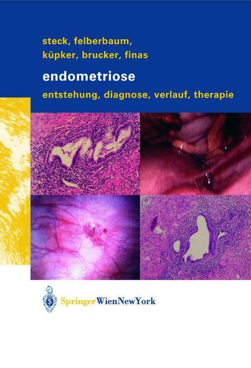 Produktbild: Endometriose