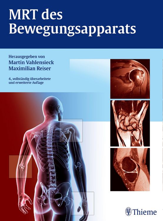Produktbild: MRT des Bewegungsapparats