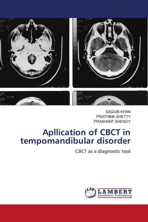 Produktbild: Apllication of CBCT in tempomandibular disorder