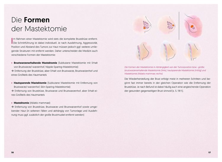 Produktbild: Diagnose Brustkrebs