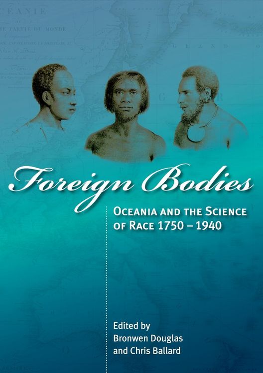 Produktbild: Foreign Bodies