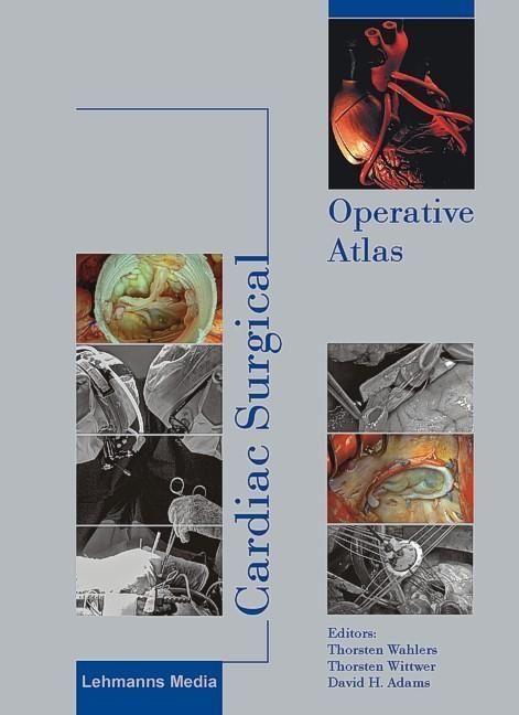 Produktbild: Cardiac Surgical Operative Atlas