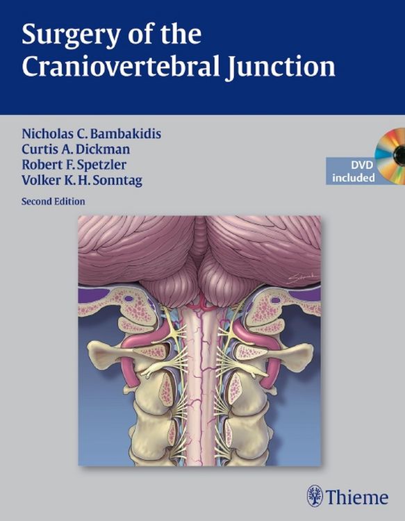 Produktbild: Surgery of the Craniovertebral Junction